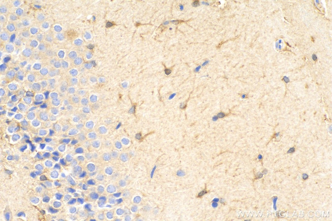 iNOS Antibody in Immunohistochemistry (Paraffin) (IHC (P))