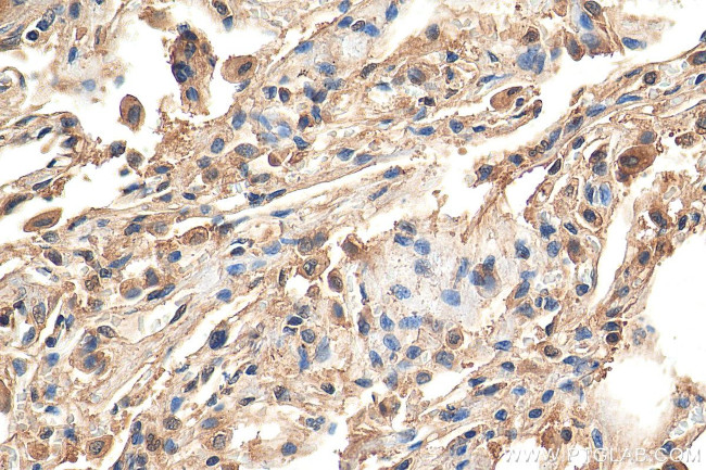 iNOS Antibody in Immunohistochemistry (Paraffin) (IHC (P))