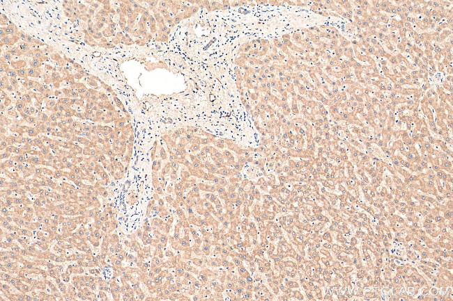 iNOS Antibody in Immunohistochemistry (Paraffin) (IHC (P))