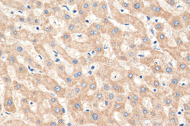 iNOS Antibody in Immunohistochemistry (Paraffin) (IHC (P))