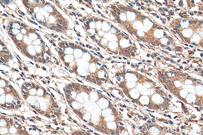 iNOS Antibody in Immunohistochemistry (Paraffin) (IHC (P))