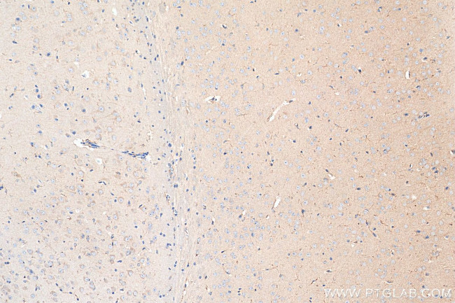 iNOS Antibody in Immunohistochemistry (Paraffin) (IHC (P))