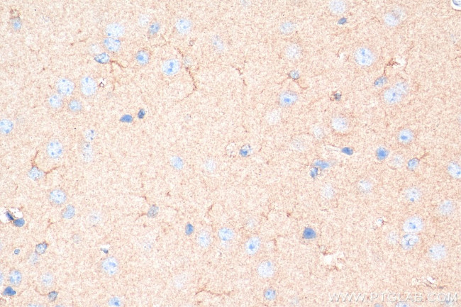 iNOS Antibody in Immunohistochemistry (Paraffin) (IHC (P))