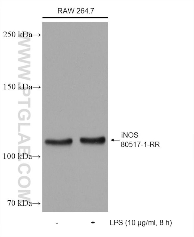 iNOS Antibody in Western Blot (WB)