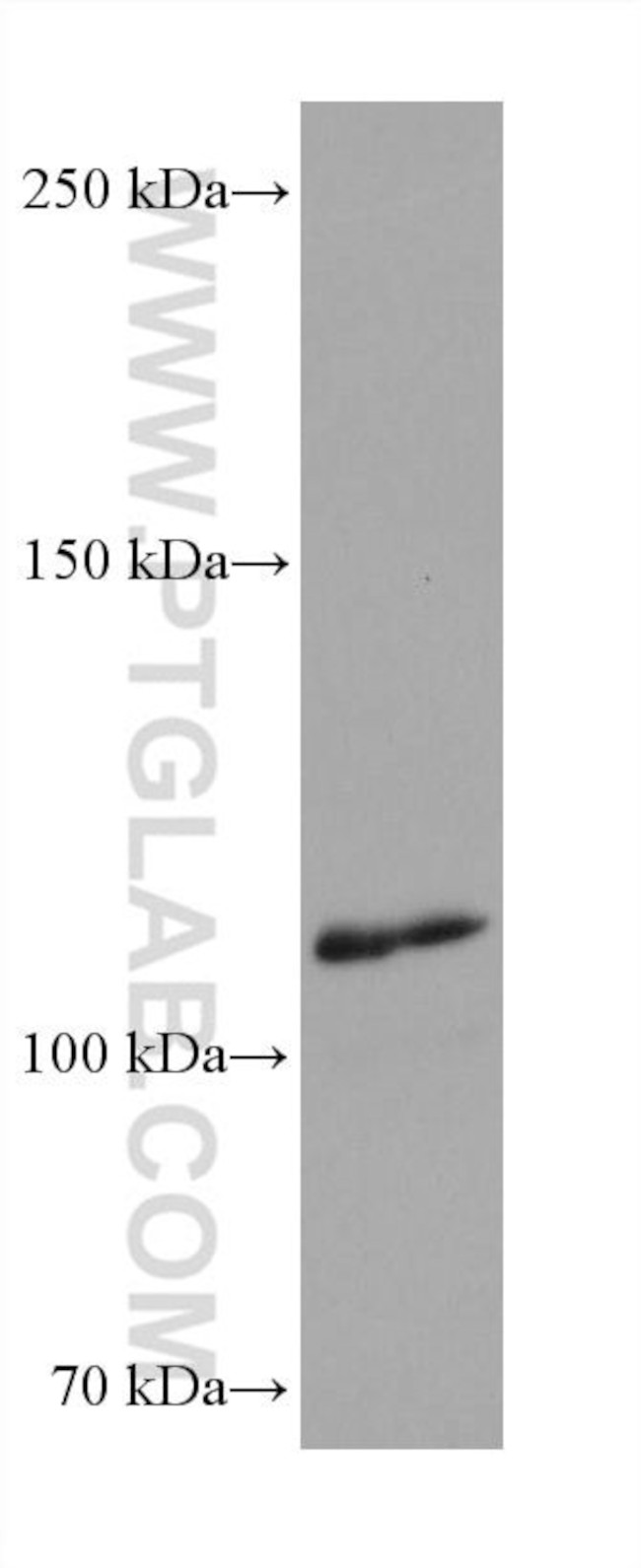 iNOS Antibody in Western Blot (WB)