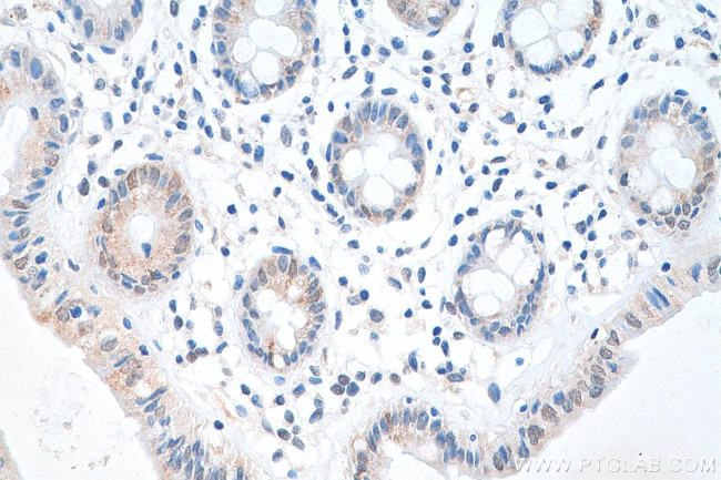 IRF3 Antibody in Immunohistochemistry (Paraffin) (IHC (P))