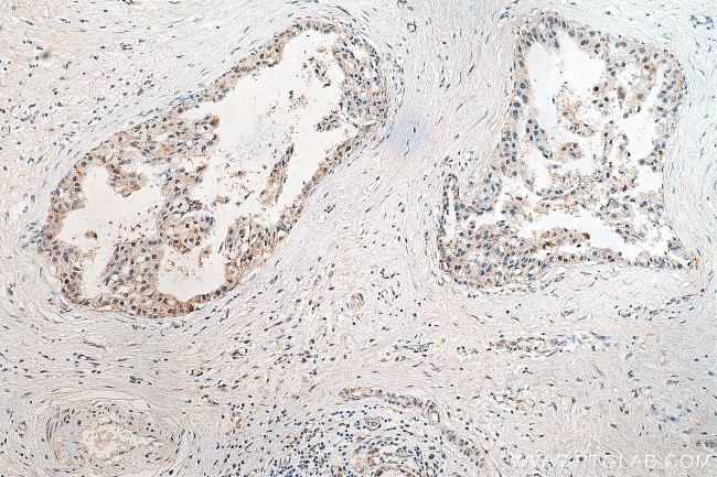 IRF3 Antibody in Immunohistochemistry (Paraffin) (IHC (P))