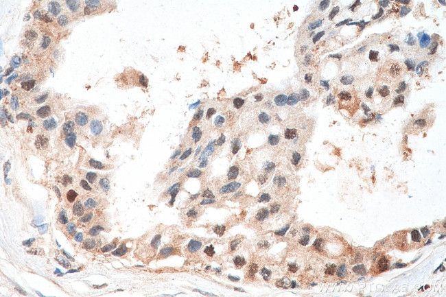 IRF3 Antibody in Immunohistochemistry (Paraffin) (IHC (P))