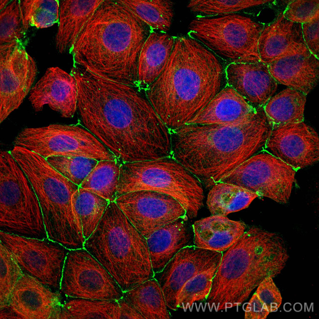 Occludin Antibody in Immunocytochemistry (ICC/IF)