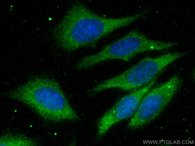 NRF2, NFE2L2 Antibody in Immunocytochemistry (ICC/IF)