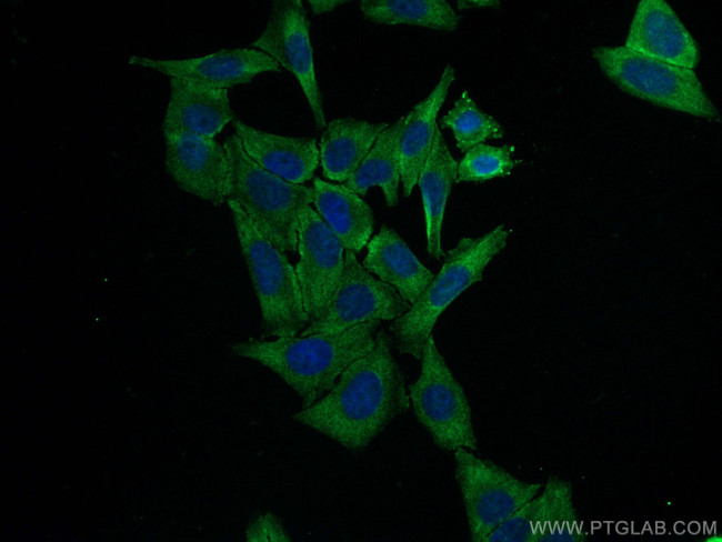 NRF2, NFE2L2 Antibody in Immunocytochemistry (ICC/IF)