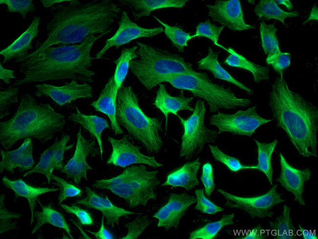 Beta Tubulin Antibody in Immunocytochemistry (ICC/IF)