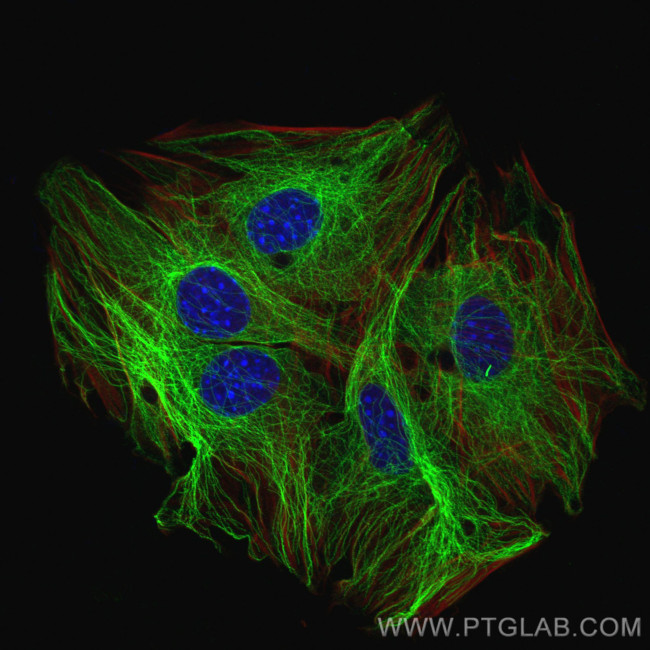 Beta Tubulin Antibody in Immunocytochemistry (ICC/IF)