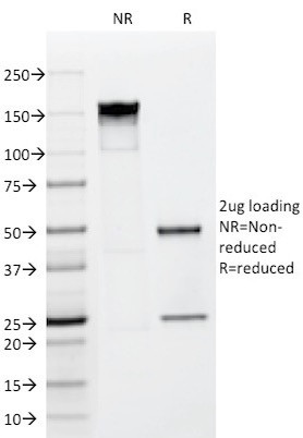 FGF23 (Fibroblast Growth Factor 23) Antibody in SDS-PAGE (SDS-PAGE)