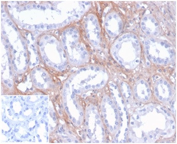 FGF23 (Fibroblast Growth Factor 23) Antibody in Immunohistochemistry (Paraffin) (IHC (P))