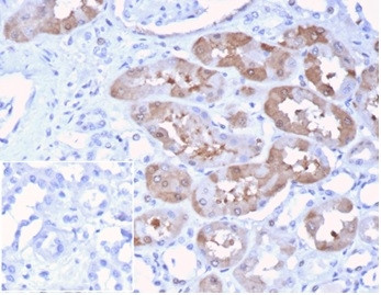 FGF23 (Fibroblast Growth Factor 23) Antibody in Immunohistochemistry (Paraffin) (IHC (P))