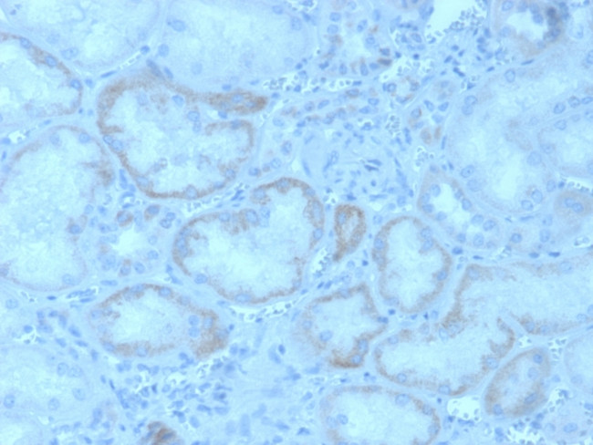 FGF23 (Fibroblast Growth Factor 23) Antibody in Immunohistochemistry (Paraffin) (IHC (P))