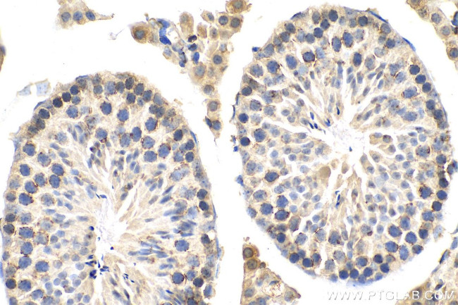 STAR Antibody in Immunohistochemistry (Paraffin) (IHC (P))