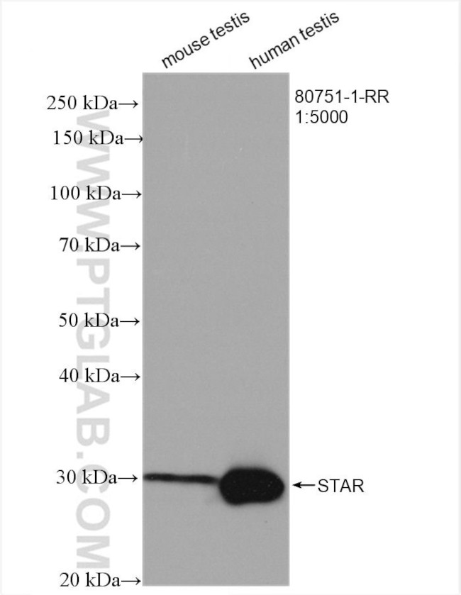 STAR Antibody in Western Blot (WB)