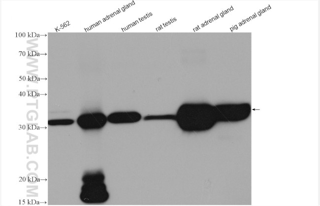 STAR Antibody in Western Blot (WB)