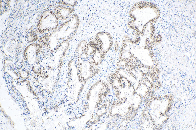 PAX8 Antibody in Immunohistochemistry (Paraffin) (IHC (P))