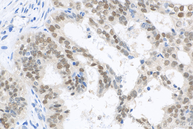 PAX8 Antibody in Immunohistochemistry (Paraffin) (IHC (P))