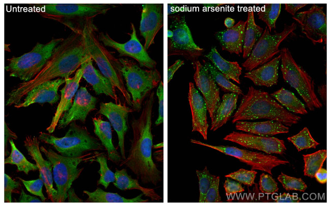 G3BP1 Antibody in Immunocytochemistry (ICC/IF)