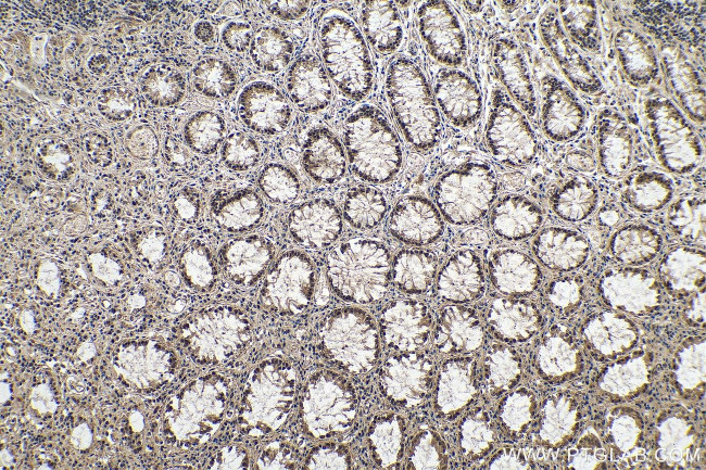 METTL14 Antibody in Immunohistochemistry (Paraffin) (IHC (P))