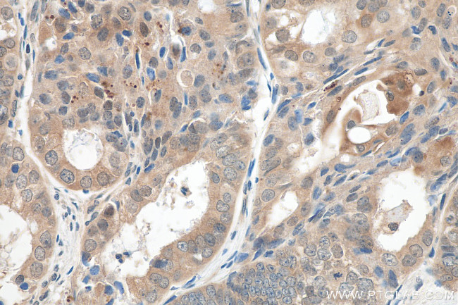 AKT1 Antibody in Immunohistochemistry (Paraffin) (IHC (P))