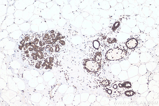 Lamin B1 Antibody in Immunohistochemistry (Paraffin) (IHC (P))