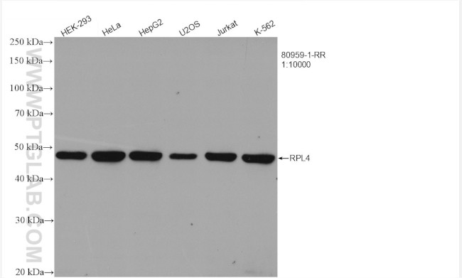 Ribosomal protein L4 Antibody in Western Blot (WB)