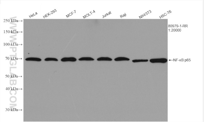 NF-kappa B p65 Antibody in Western Blot (WB)