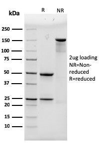 Alpha Actinin 4/ACTN4 Antibody in SDS-PAGE (SDS-PAGE)