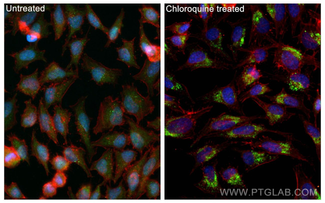 LC3 Antibody in Immunocytochemistry (ICC/IF)