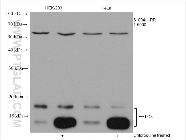 LC3 Antibody in Western Blot (WB)