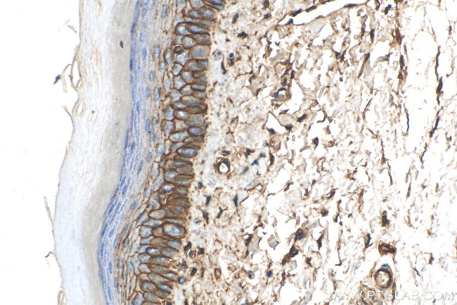 S100A10 Antibody in Immunohistochemistry (Paraffin) (IHC (P))