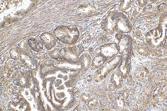 S100A10 Antibody in Immunohistochemistry (Paraffin) (IHC (P))