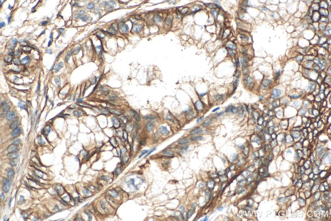 S100A10 Antibody in Immunohistochemistry (Paraffin) (IHC (P))