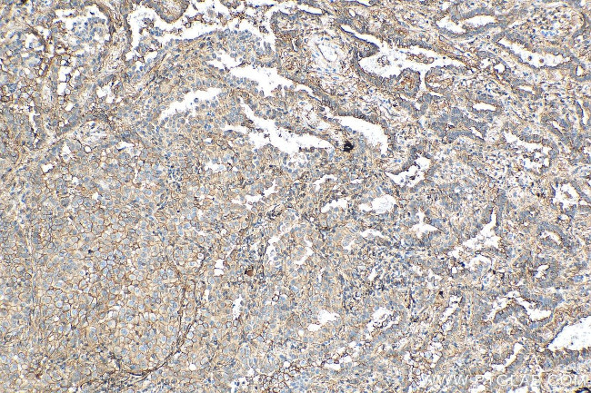 S100A10 Antibody in Immunohistochemistry (Paraffin) (IHC (P))