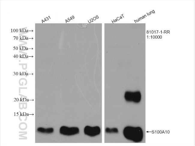 S100A10 Antibody in Western Blot (WB)