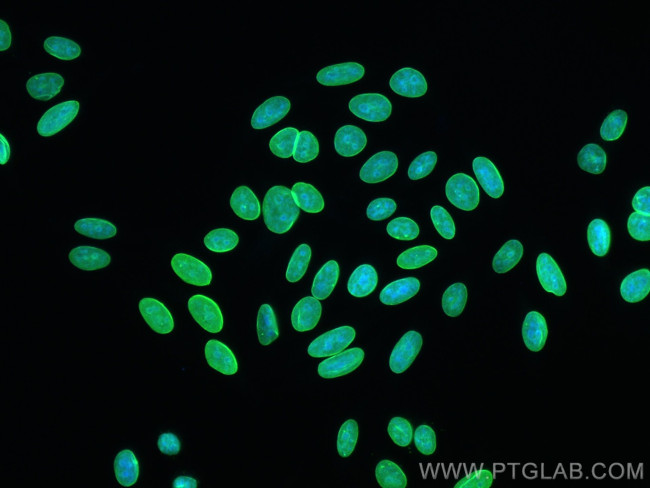 Lamin A/C Antibody in Immunocytochemistry (ICC/IF)