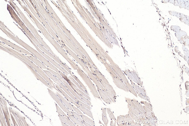 YAP1 Antibody in Immunohistochemistry (Paraffin) (IHC (P))