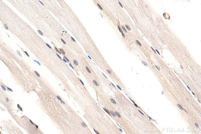 YAP1 Antibody in Immunohistochemistry (Paraffin) (IHC (P))