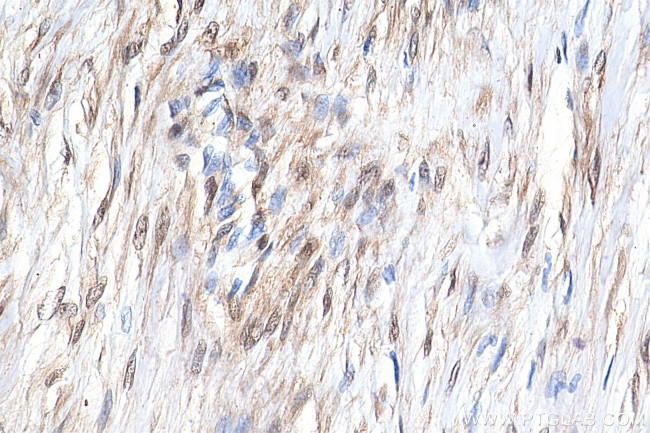 YAP1 Antibody in Immunohistochemistry (Paraffin) (IHC (P))