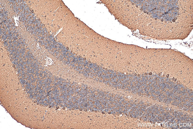 PSD95 Antibody in Immunohistochemistry (Paraffin) (IHC (P))