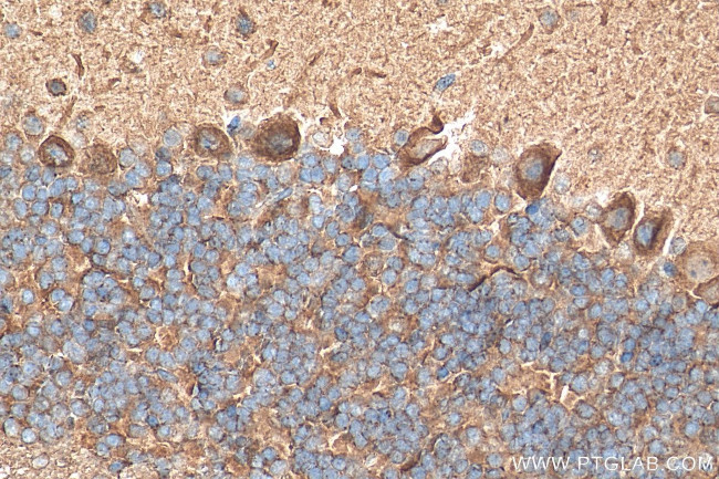 PSD95 Antibody in Immunohistochemistry (Paraffin) (IHC (P))