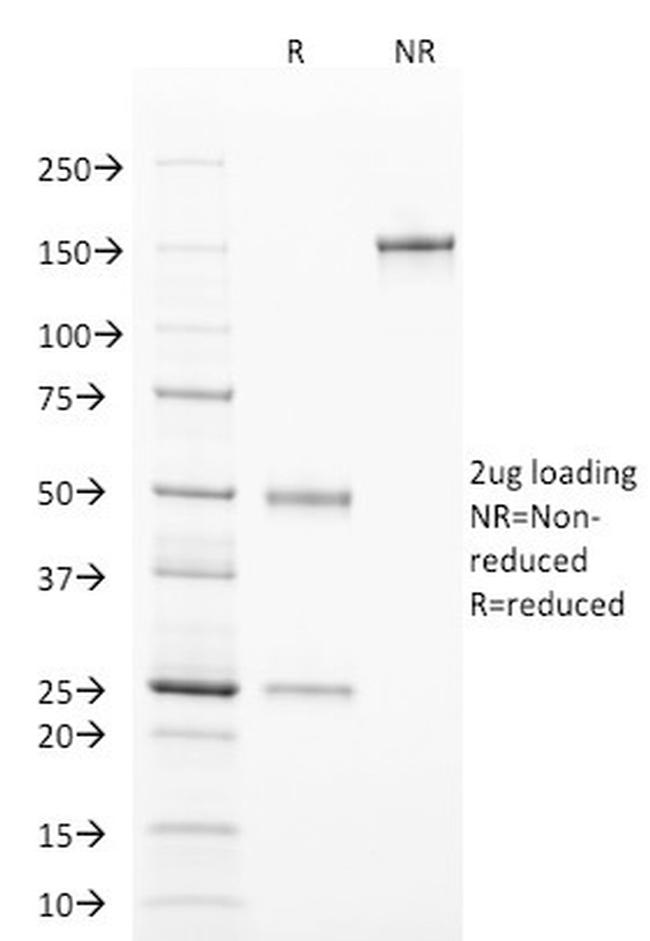 TCL1 Antibody in SDS-PAGE (SDS-PAGE)