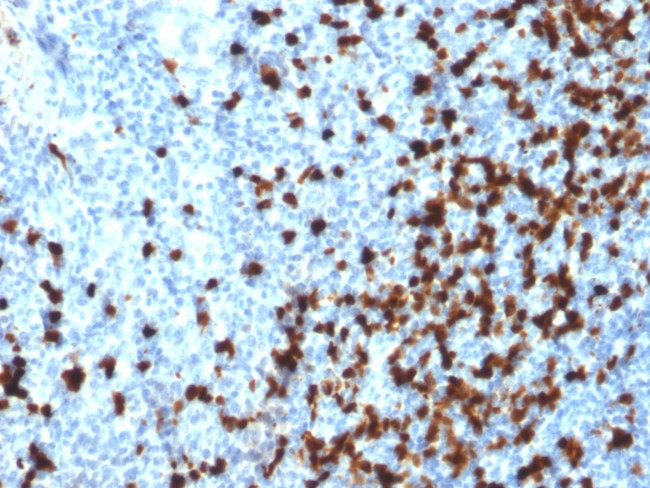 TCL1 Antibody in Immunohistochemistry (Paraffin) (IHC (P))