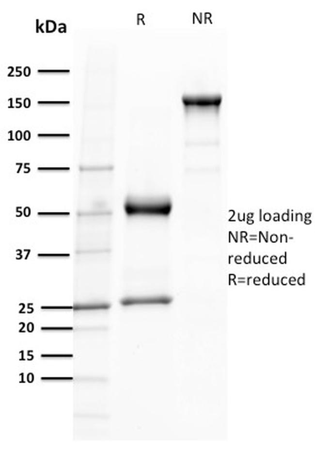 TCL1 Antibody in SDS-PAGE (SDS-PAGE)