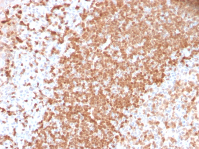 TCL1 Antibody in Immunohistochemistry (Paraffin) (IHC (P))